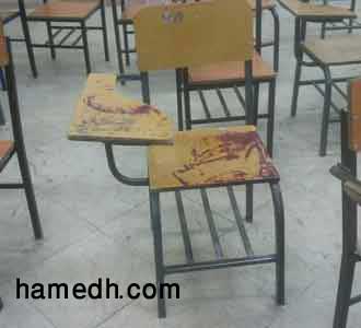 صندلی خونی صندلی خونی